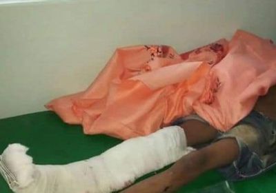 إصابة طفل وامرأة برصاص قناص حوثي شمال الضالع