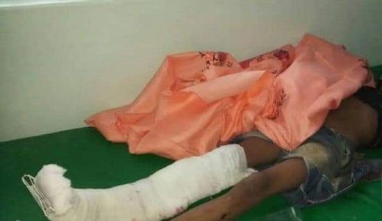 إصابة طفل وامرأة برصاص قناص حوثي شمال الضالع