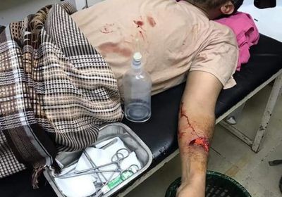 لجهله بالأمور العسكرية.. إصابة " القباطي " خلال تنفيذ أنشطة مشبوهة بأحد المعسكرات  