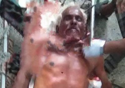 استشهاد مواطن وإصابة آخر جراء قصف حوثي على الأحياء السكنية في حيس