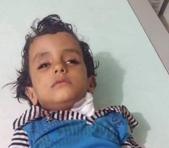 عاجل..إصابة طفل برصاص المليشيات في قرية الشغادر وسط حجر