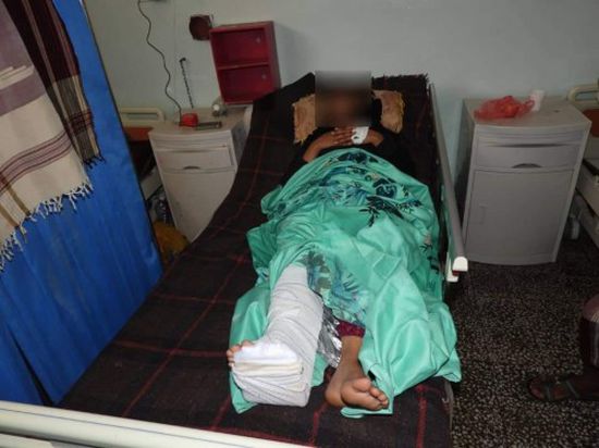 انتهاك جديد للمليشيات..إصابة امرأة حامل برصاصة قناص حوثي شمال غرب الضالع