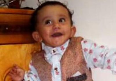 وفاة طفل بعد إصابته بحمى الضنك بردفان