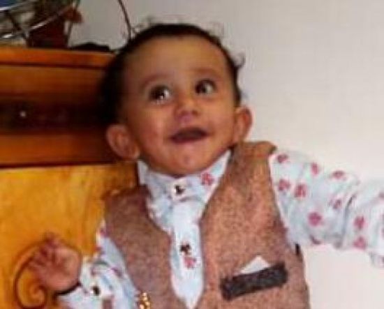 وفاة طفل بعد إصابته بحمى الضنك بردفان