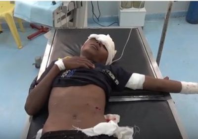 مليشيات الحوثي تطلق النار على طفل يرعى الأغنام في حيس (فيديو)