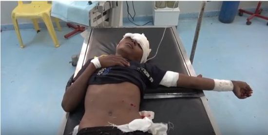مليشيات الحوثي تطلق النار على طفل يرعى الأغنام في حيس (فيديو)