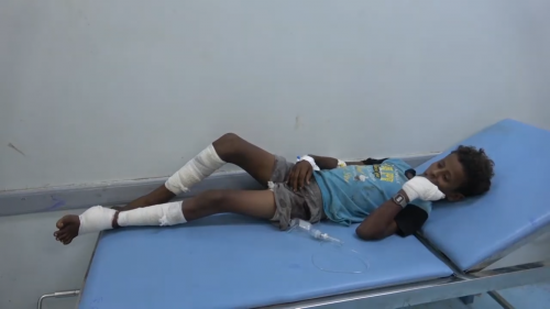 إصابة 4 أطفال وامرأة في قصف حوثي على الأحياء السكنية في الدريهمي (فيديو)