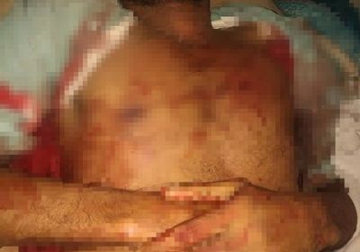 القبض على المتهم بقتل شاب في تبن بلحج..تفاصيل