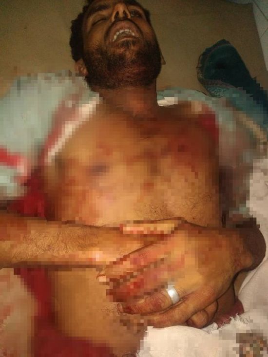 القبض على المتهم بقتل شاب في تبن بلحج..تفاصيل