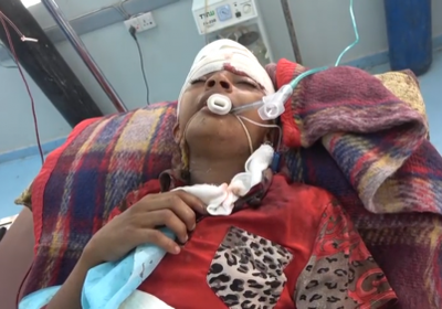 إصابة طفلين بقصف حوثي على منازل المواطنين بالتحيتا(فيديو)