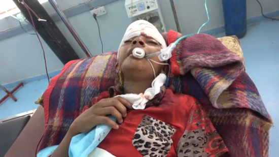 إصابة طفلين بقصف حوثي على منازل المواطنين بالتحيتا(فيديو)