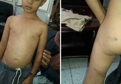 متطرف يعذب طفل بطريقة وحشية ويحرق "عضوه الذكري" في تعز   