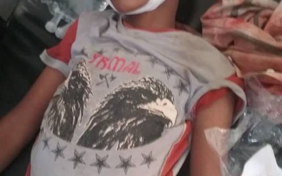 استشهاد طفل برصاص قناص حوثي في حيس بالحديدة