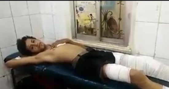 استشهاد طفلة وإصابة 3 آخرين من عائلة واحدة بقصف حوثي شمالي الضالع