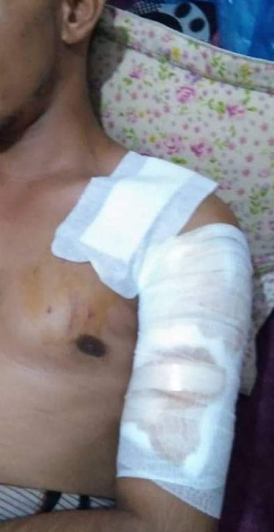 مسلحون يعتدون بالضرب والطعن على مسئول بمستشفى الثورة بتعز 