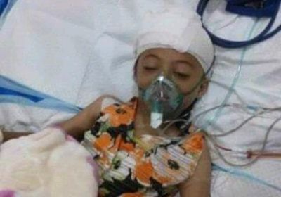 استشهاد الطفلة تغريد جراء إصاباتها بصاروخ حوثي بقعطبة