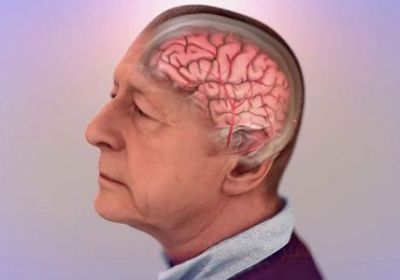 علماء بريطانيون يتوصلون لعلاج رائد يكافح شيخوخة الدماغ