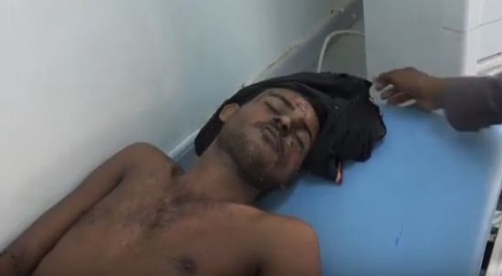 إصابة مواطن بجروح خطيرة في قصف حوثي جنوب الحديدة 