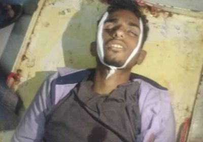 عاجل.. مقتل جندي في قصف حوثي على موقع عسكري بتعز