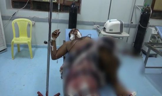 قناصة الحوثي تستهدف المنازل بحيس وتصيب أحد المواطنين
