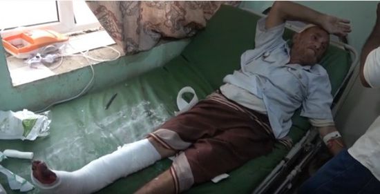 قناصة المليشيات تطلق النار على المارة في حيس وتصيب أحد المواطنين (فيديو)