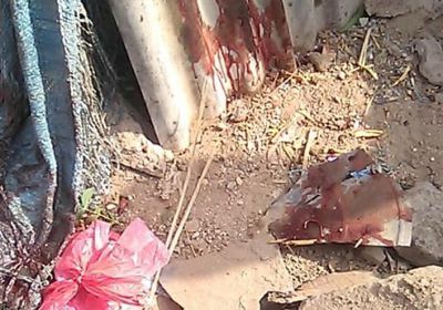 الرابع بين الحياة والموت.. ارتفاع ضحايا تفجير لحج إلى 3 أطفال