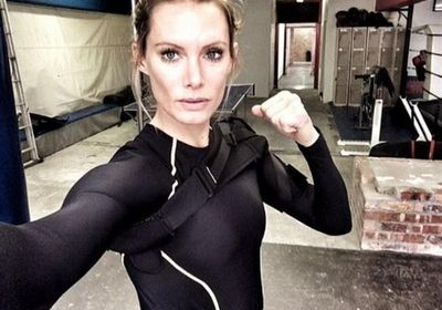 ممثلة أمريكية تقاضي منتج بعد بتر ذراعها