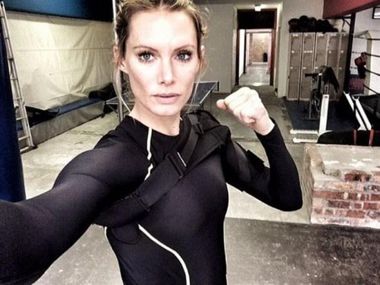 ممثلة أمريكية تقاضي منتج بعد بتر ذراعها