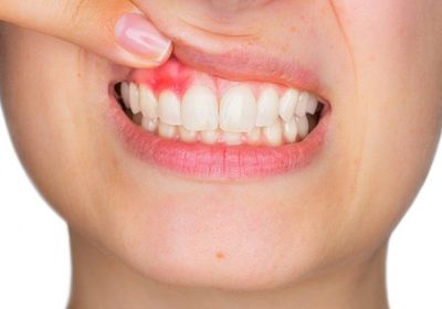 باحثون.. صحة الفم تؤثر على المخ والوظائف المعرفية