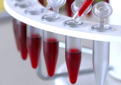 باحثون يبتكرون فحص دم يمكنه التنبؤ بالعمر الافتراضي للإنسان