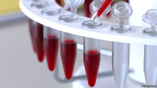 باحثون يبتكرون فحص دم يمكنه التنبؤ بالعمر الافتراضي للإنسان