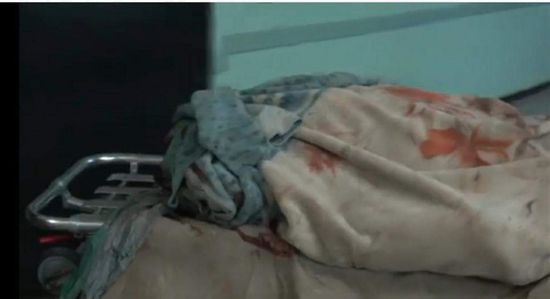 استشهاد مواطن وإصابة آخر في انفجار عبوة ناسفة حوثية بالحديدة (فيديو)