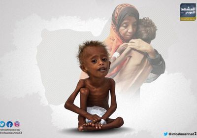 مليونا طفل يصارعون الموت في اليمن بسبب سوء التغذية (انفوجراف) 