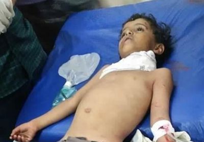 استشهاد طفل في قصف حوثي على قرية المشاريح بشمال الضالع