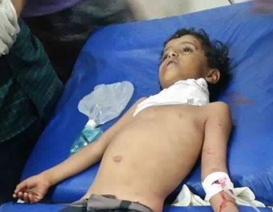 استشهاد طفل في قصف حوثي على قرية المشاريح بشمال الضالع