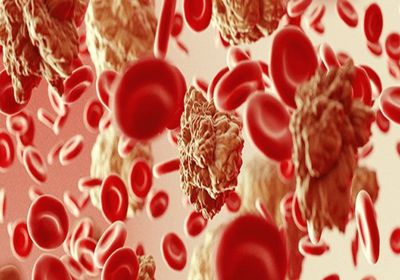 علماء بريطانيون يكتشفون تقنية جديدة للتخلص من "سرطان الدم"