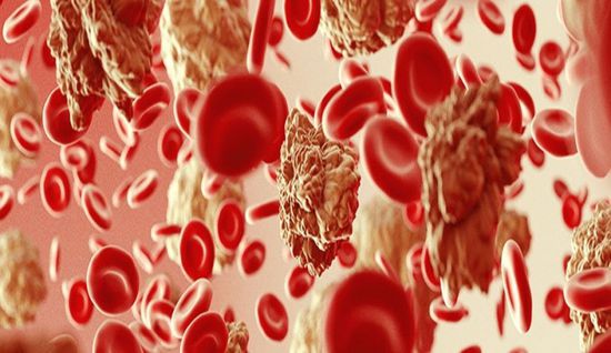 علماء بريطانيون يكتشفون تقنية جديدة للتخلص من "سرطان الدم"
