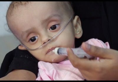 بيحان..صرخة ألم ضد حمى الضنك ونداء استغاثة للمنظمات الطبية