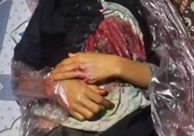 رصاصة مجهولة تقطف طفلة من أسرتها في حي كلابة بتعز