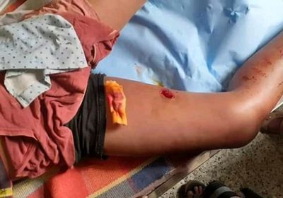 إصابات بصفوف المدنيين.. مليشيا الحوثي تستهدف قرى حيفان