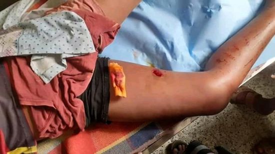 إصابات بصفوف المدنيين.. مليشيا الحوثي تستهدف قرى حيفان
