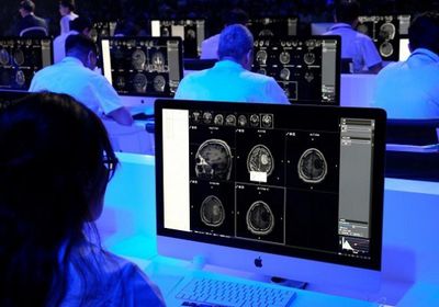دراسة.. الذكاء الاصطناعي الأفضل في تشخيص أورام الدماغ