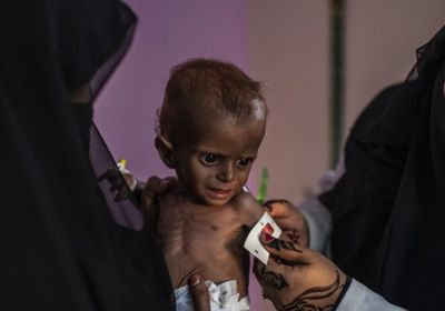 الاستهداف الحوثي للمنظمات الإغاثية.. مليشياتٌ لا تعرف الرحمة