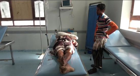 مليشيات الحوثي تصيب مواطنا بجروح خطيرة في قرية السقف بالجبلية (فيديو)