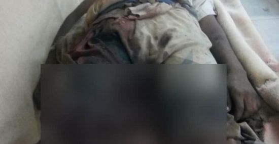 لغم حوثي يحصد حياة طفل جديد في المسنا بالحديدة
