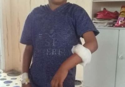 بـ 3 ضحايا.. الكلاب المسعورة تؤرق أهالي زنجبار  