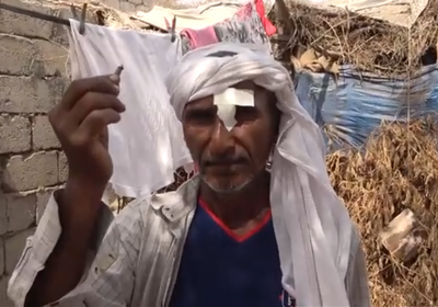 إصابة مواطن برصاص مليشيات الحوثي داخل منزله في حيس بالحديدة (فيديو)