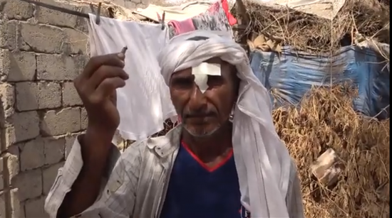 إصابة مواطن برصاص مليشيات الحوثي داخل منزله في حيس بالحديدة (فيديو)