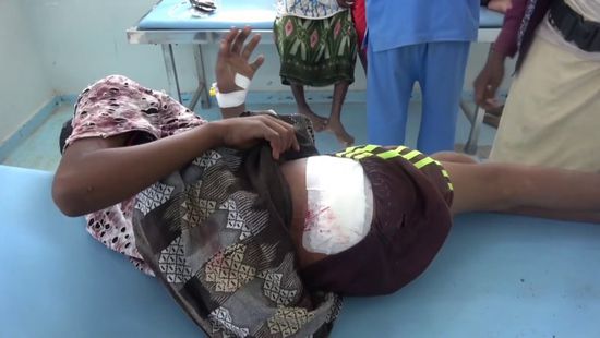إصابة طفل في عدوان حوثي على مزارع الجبلية (فيديو)