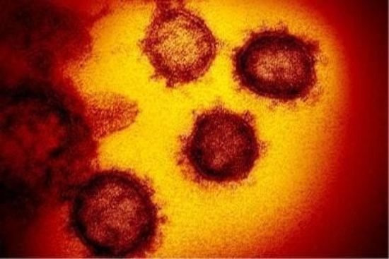 أول صور مجهرية لفيروس كورونا (صور)